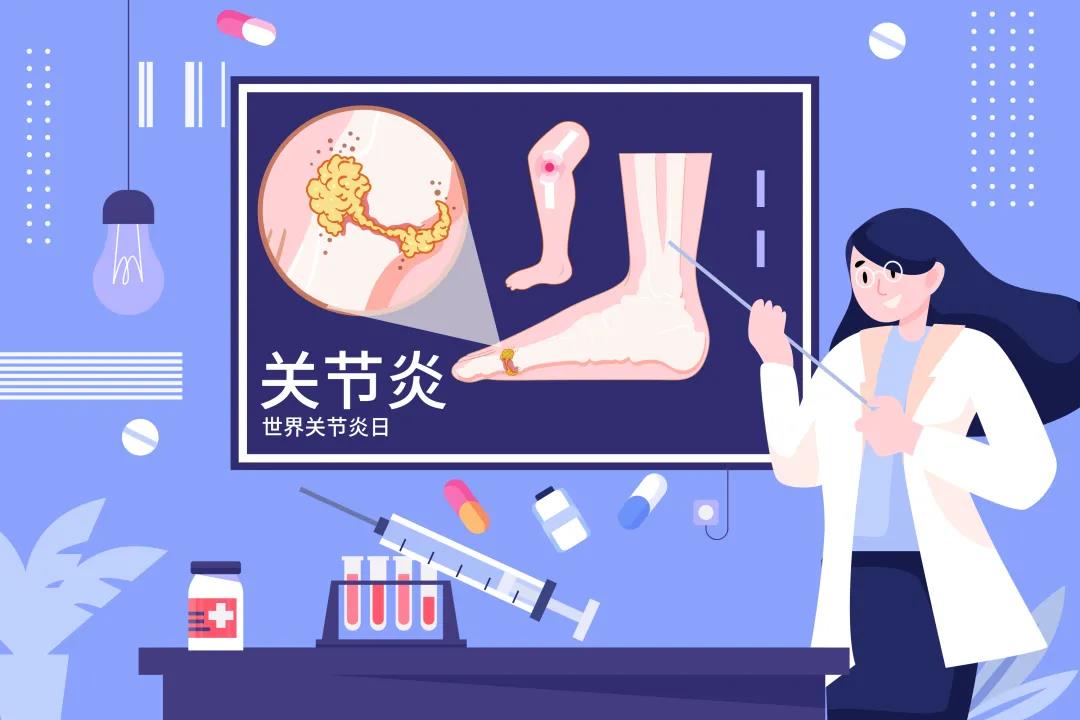 鹽城康復(fù)：“關(guān)節(jié)炎怎么辦”？